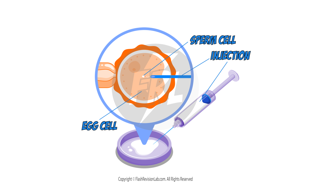 IVF Injection